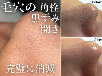 キャンディ 難波心斎橋店(CANDi)