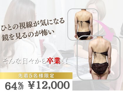 キリグ(KILIG)の写真