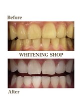 ホワイトニングショップ 葵区静岡駅店/ホワイトニング店ホワイトニング