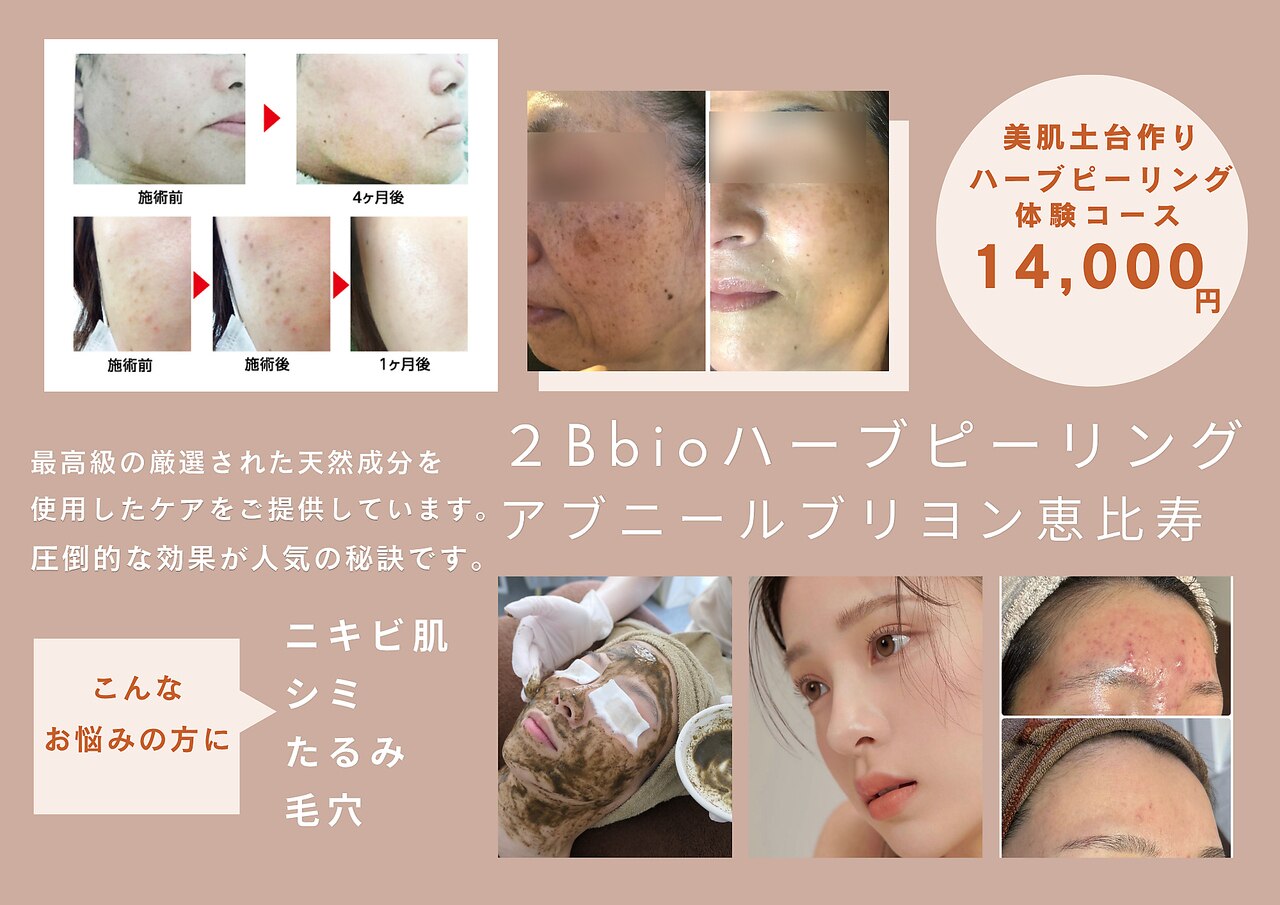 ハーブピーリング アブニールブリヨン｜ホットペッパービューティー