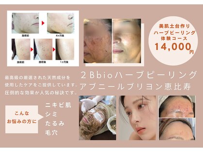 アブニールブリヨンの写真