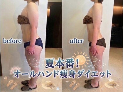 アンクール(esthetic salon uncoeur)の写真
