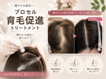 リベルテ(Liberte)の写真