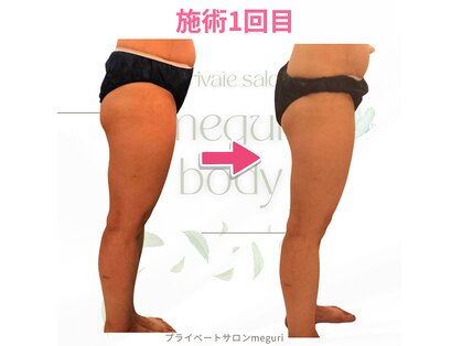 メグリ(meguri)の写真