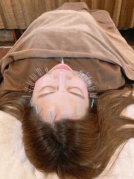 アキュティ 吉祥寺(Acuty)/小顔美容鍼+肩頸鍼施術