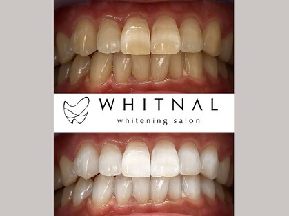 ホワイトナル(WHITNAL)の写真