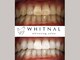 ホワイトナル(WHITNAL)の写真