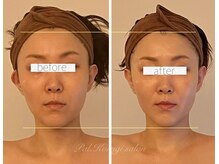 パル コルギサロン(Pal. Korugi salon)/コルギビフォーアフター