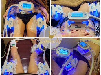 カメリー座薫 大阪上本町本店の写真/夏に向けて美BODYを磨きたい方★[お腹/前or横or裏もも/二の腕/あご下]から選べる冷却痩身*一か所¥3980！