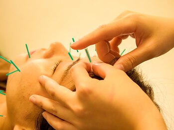 メディカルスパ みなとみらい鍼灸院の写真/年齢を重ねると気になるホウレイ線・たるみを改善!美容鍼でお肌のハリを取り戻し、ワンランク上の美肌へ♪