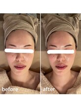 アルテ(ART-e)/Before/Afterプレ花嫁様体験