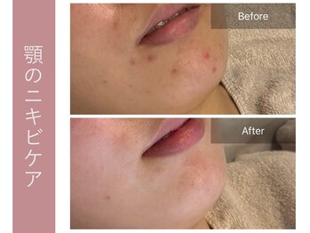 ジョルネ 中目黒(jornee.)/before/after