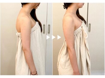 アマリエ/before after