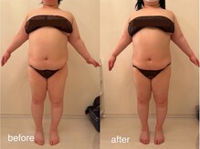 クロレ 浦和店(CLORE)/30代のお客様/8回施術