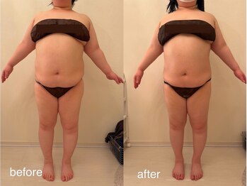 クロレ 浦和店(CLORE)/30代のお客様/8回施術