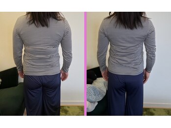 リセットモア(Reset More)/before after 1回の施術の変化