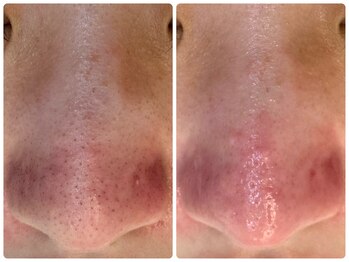 サイセイ(SAISEI)/