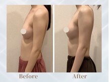 ふじこのみらい by ラディアンヌ/