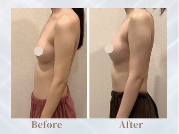 ふじこのみらい by ラディアンヌ/