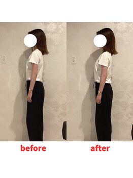ナオル整体 福岡香椎院(NAORU整体)/20代女性施術事例【姿勢改善】