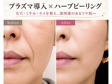 エンズ 米野木店(0's)/