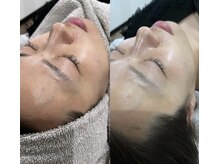 アイアール(ir)/