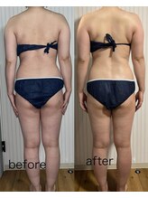 オリス(ORRIS)/ビフォーアフター