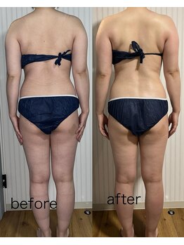 オリス(ORRIS)/ビフォーアフター