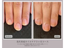 育成事例は毎日Instagram更新中！【@nail.care.osaka】で検索♪