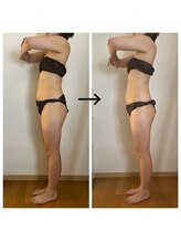 リオラ ビューティー(Liora beauty)/《before/after》