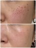 ★光の糸でお悩み丸ごとケア！今まで効果を感じた事ない方！お任せ結果重視！