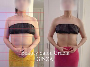 グラツィア 銀座(Grazia)/6回【 ブライダルエステ整体 】