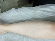 ナノハナ/鹿沼市の全身脱毛美容室ナノハナ