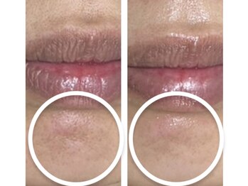 ナナマルニ 高知店(702)/人気★フェイシャルメニュー