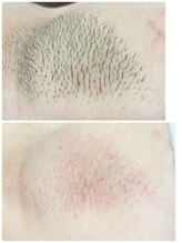 エン(en.)/BeforeAfter写真40