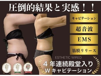 ヨロ 梅郷店(YOLO)/Wキャビテーションで脂肪撃退！