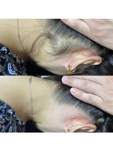 ティグレ 岡山店(TIGRE)/うなじWAX脱毛