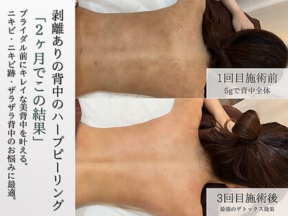 ホクビューティー(HOCU BEAUTY)の写真