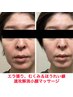 人気NO1筋膜リリースで速攻小顔!筋肉の過緊張を緩める顔＆ヘッドマッサージ