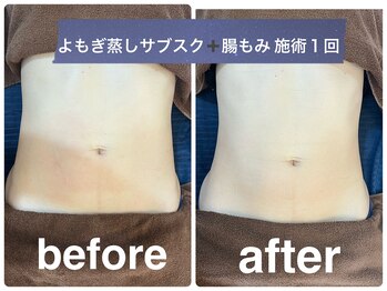 デューン 蕨店(Dune)/よもぎ蒸し/腸もみ