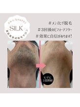 シルク(Silk)/・メンズ様も可能◎