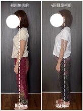 ベルサンテ イオ(belle sante'io)/整体＋頭蓋調整90分コース　