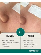 リベレ(Libelle)/毛穴悩みの方に