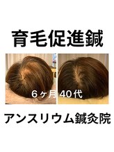 アンスリウム美容整体院 鍼灸院 接骨院/育毛を促す鍼