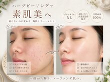 ホワイトアクア つくば店(WHITE AQUA)