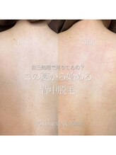 ジョエルワックス 沖縄那覇店(JOELLE WAX)/背中の毛、自己処理難しくない？