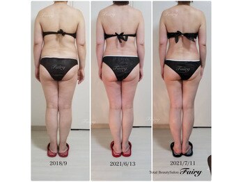 フェアリー(Fairy)/【痩身】集中プログラム