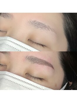 アーティカル(Artical)/ブロウリフト