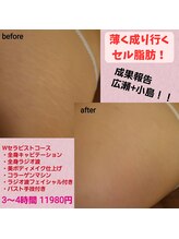 トリートメント アンド コミュ トリコ/Wセラピストコース♪