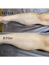 パーミル 楠葉店(per mille‰)/Before/After